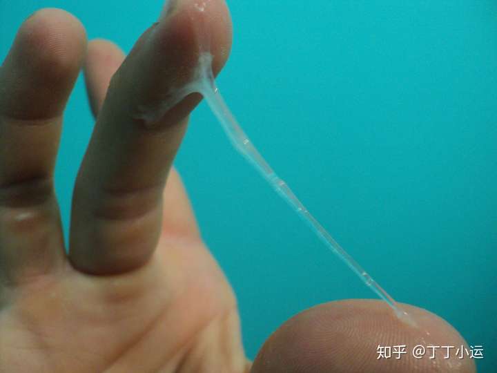 阴茎勃起后前列腺液分泌自己觉得有点多,正常吗?