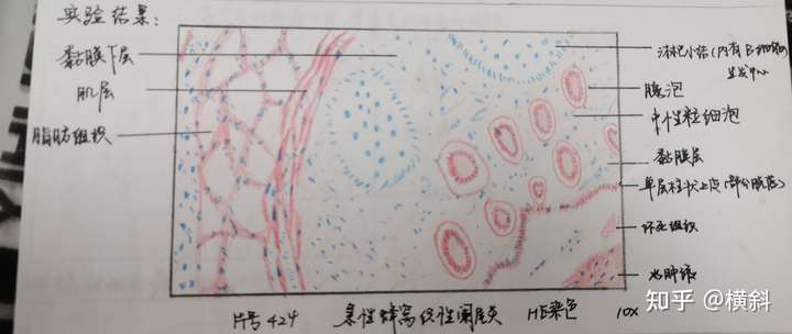 病理红蓝铅笔绘图 1.肉芽组织