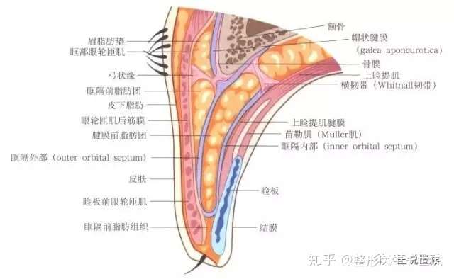 和欧美人完全相反,由于眶隔和提上睑肌腱膜融合部位在睑板上缘下方,有