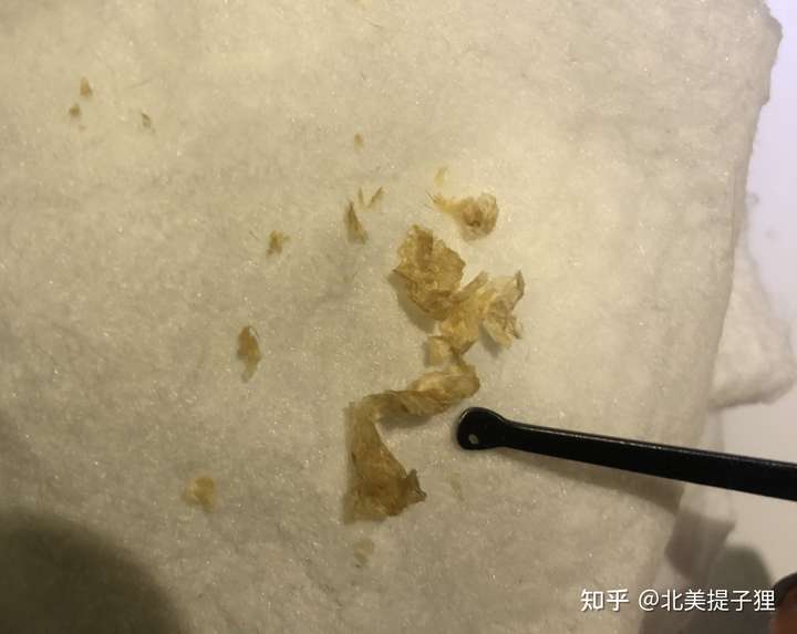 掏出一块超大耳屎,是种什么体验?