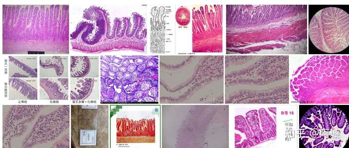 结肠和小肠在显微镜下怎么区分?