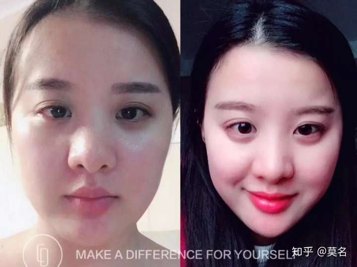下巴平的人怎么让下巴变尖?