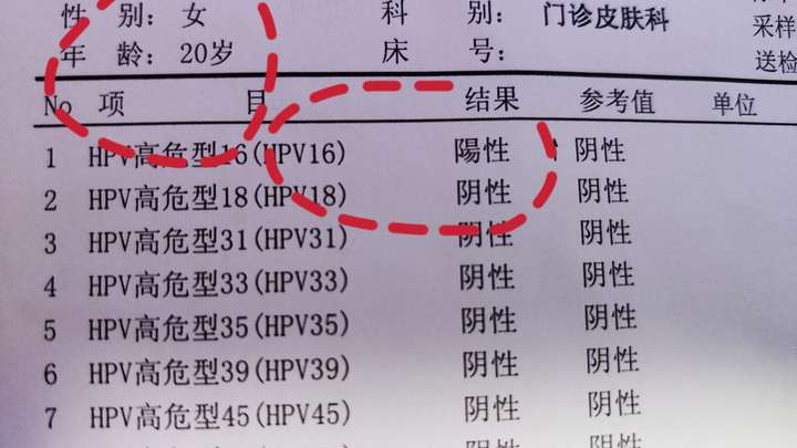 被查出来hpv16型阳性,担心?