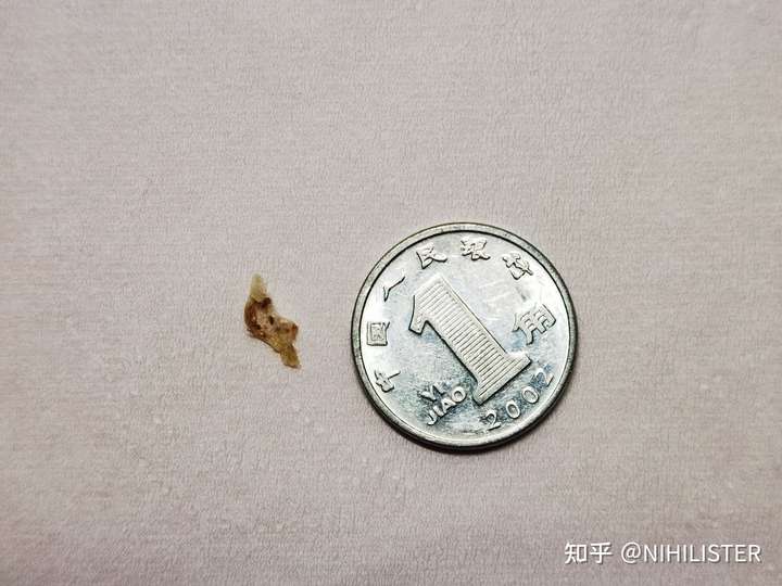 你们掏出来的耳屎有多大?