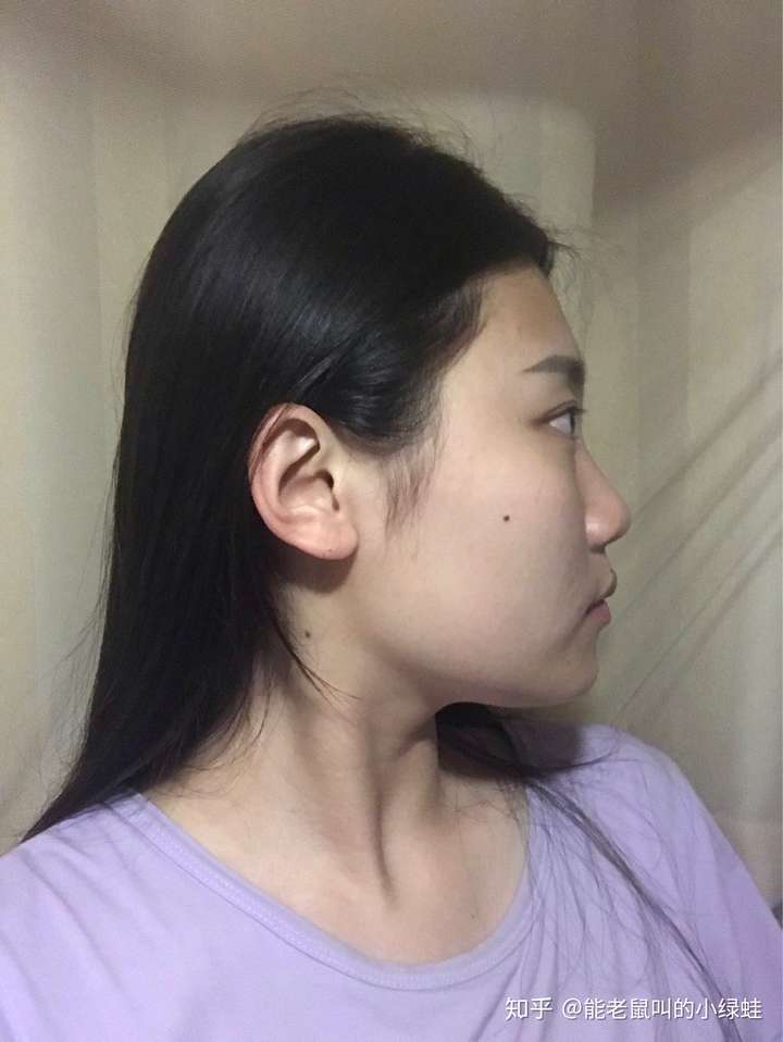 正脸好看但侧脸丑到爆是种怎样的体验?