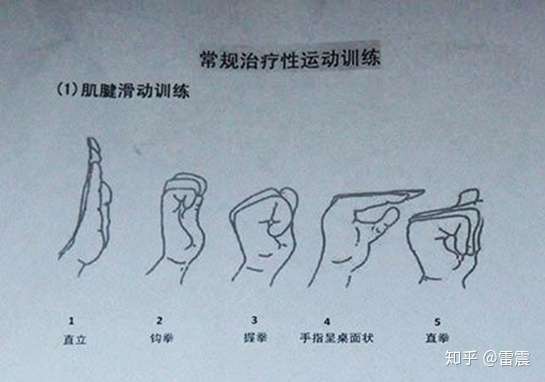 应该如何避免腕管综合征(鼠标手)的复发?