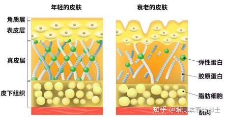 怎么护理眼部皮肤?