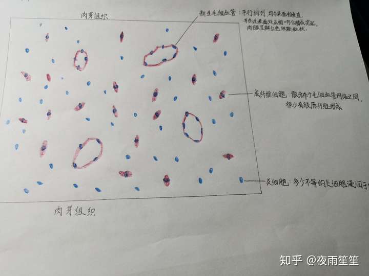 肉芽组织和血栓的红蓝铅笔手绘图怎么画?救救孩子吧!