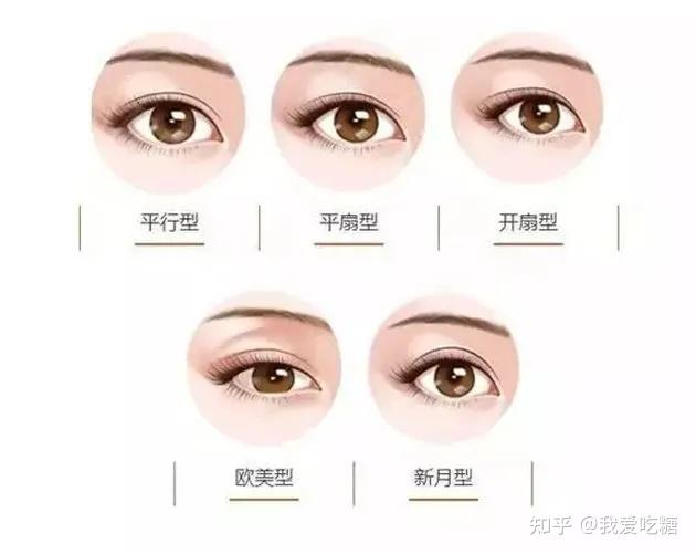 这是什么双眼皮类型?