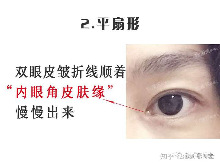 开眼角有必要吗?