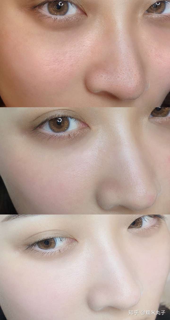 皮肤暗沉发黄怎么办?