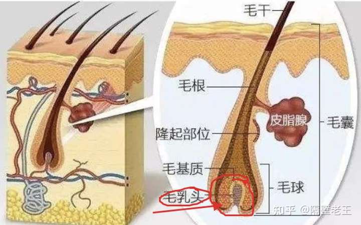 的毛发粗,是因为毛发横切面,看着比正常毛发尖端要粗 脱毛仪作用原理