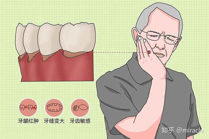 电动牙刷会加速牙龈萎缩吗?