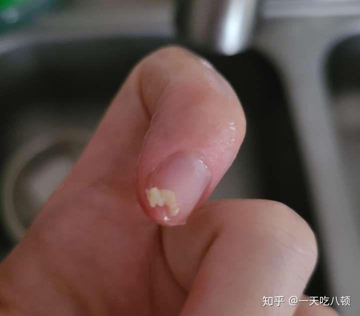 口臭 特别难闻的味道,口水都是臭的但是去医院检查不是幽门螺旋杆菌