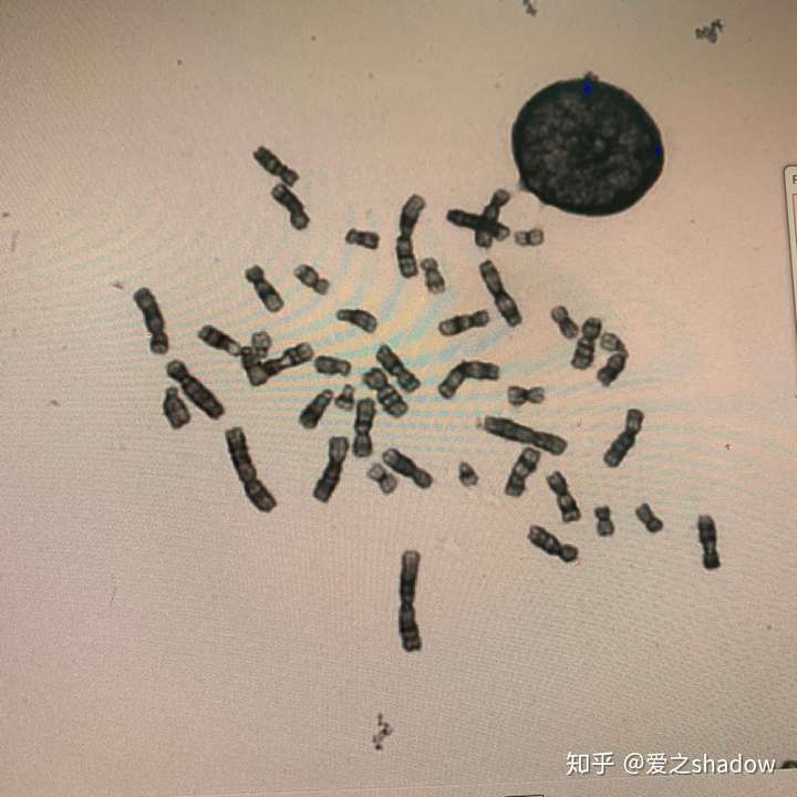 谁能告诉我怎么分辨46条染色体?