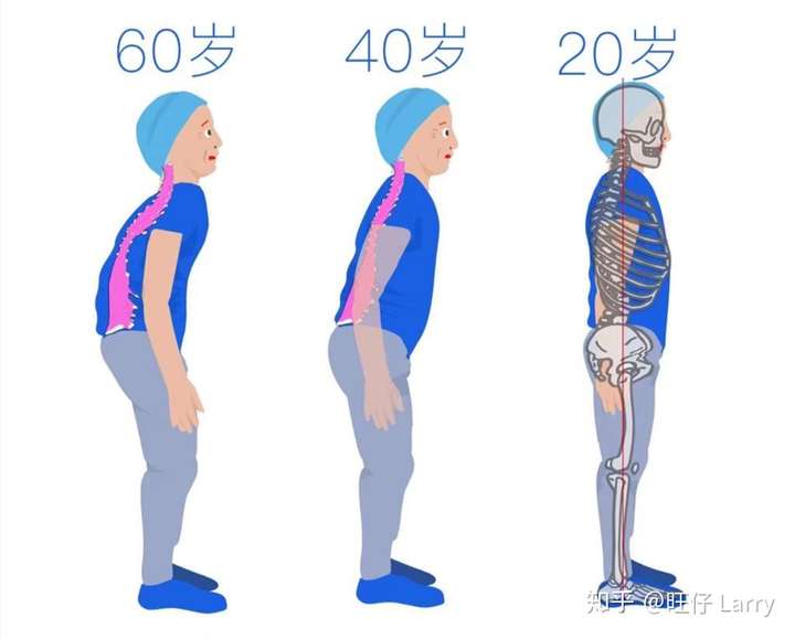 为什么人会对弯腰驼背上瘾?