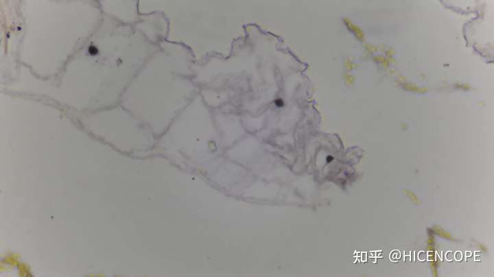 显微镜的百合花粉 这个图案当时我看的时候觉得像一只有龙身的猪