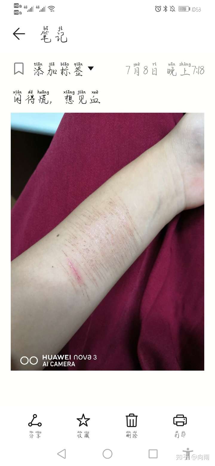 虽然我也被确诊为重度抑郁,但总感觉我没那么严重,昨天运动手环到了