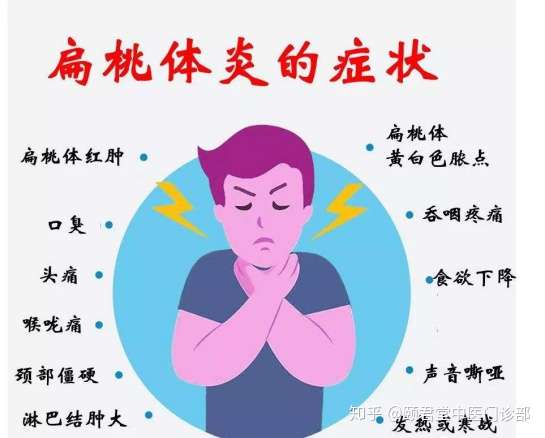 颐君堂分享扁桃体肿大的三度划分
