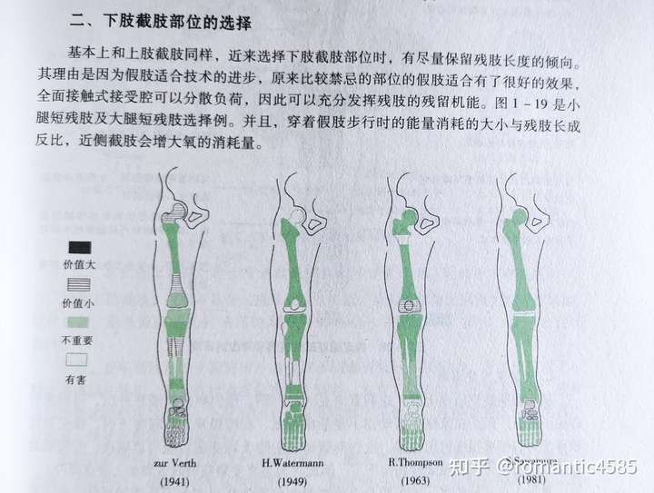 右腿小腿截肢四分之三算几级伤残?