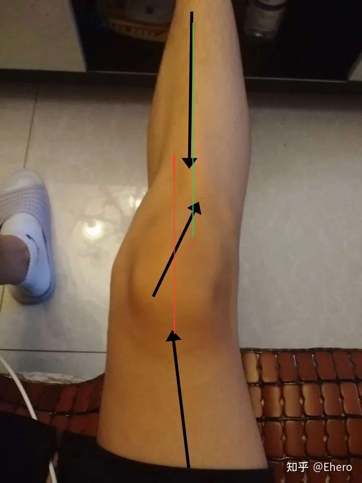可以借助外力在膝屈曲时候增加一个内旋的力(千万不要膝盖内扣).