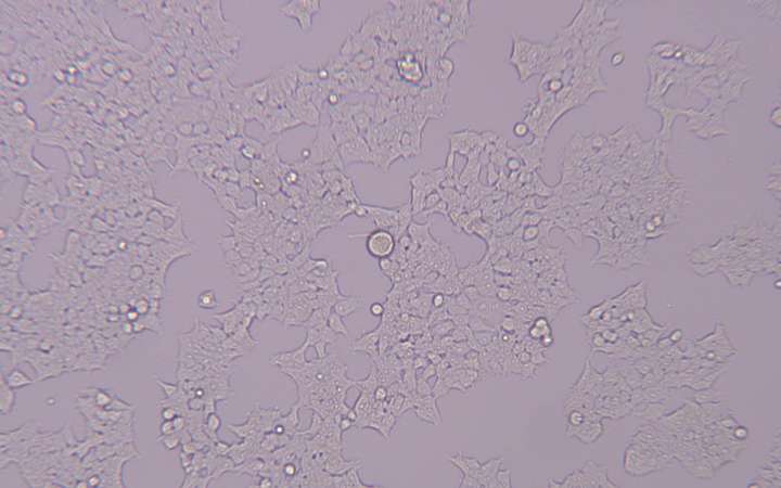 293t细胞在显微镜下的形态