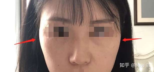 女生颧骨高应该怎么修饰?