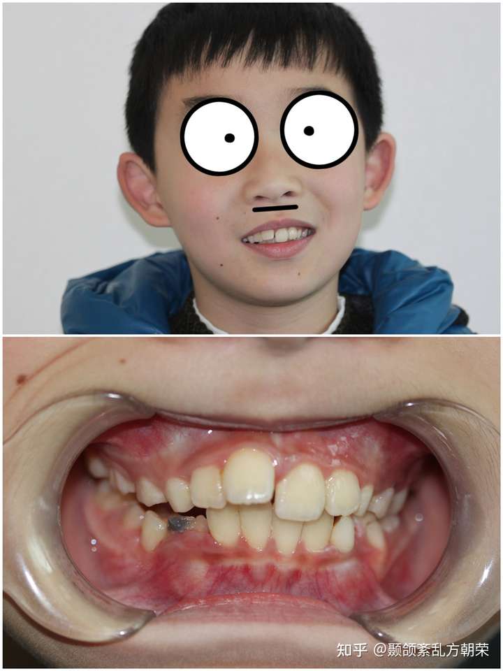 牙齿好看是一种什么样的体验?