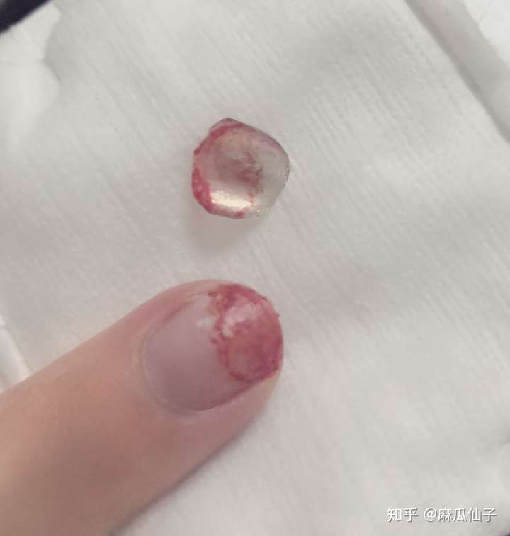 图片本来有点血腥,我加滤镜了,十个手指头有一半是这样断的,剩下的
