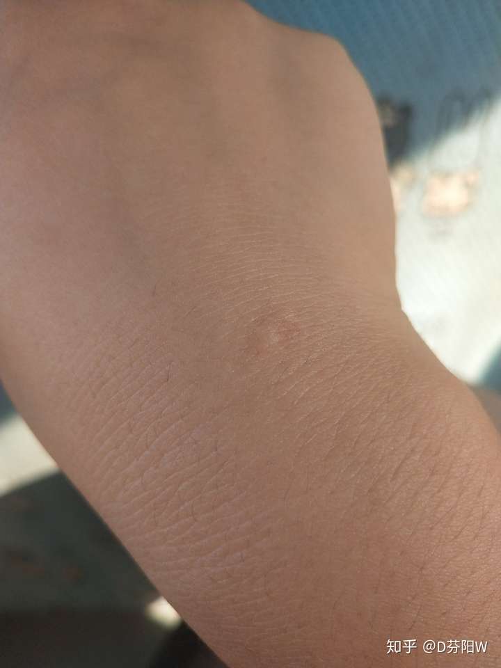 刺纹身和烫烟疤哪个疼?