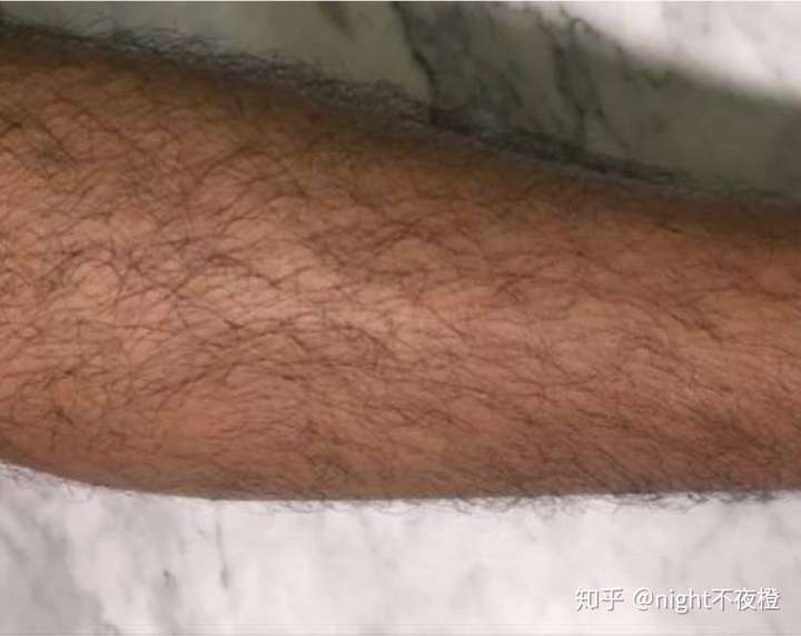 男生腿毛重要不要刮