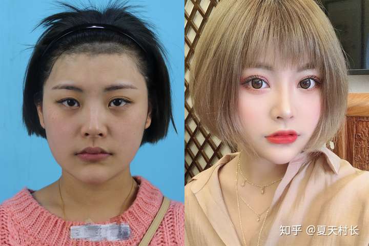 南京哪个整形医院比较好