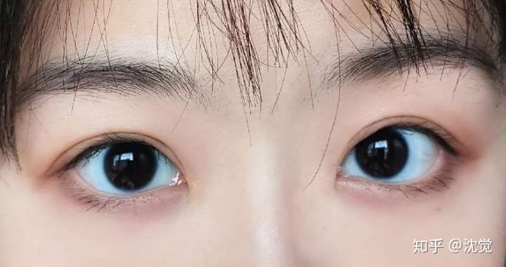 为什么我的瞳孔是纯黑的看别人的瞳孔都是褐色茶色觉得好漂亮啊