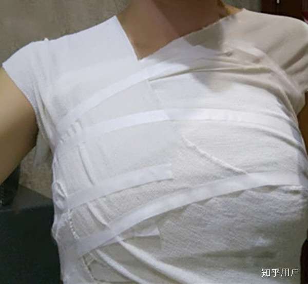 假体隆胸恢复期是怎样的过程?