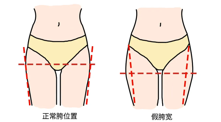 你的小短腿可能是假胯宽