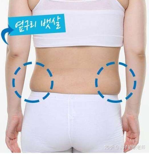 为什么有些女生明明已经很瘦,下腹还是会有不少赘肉?