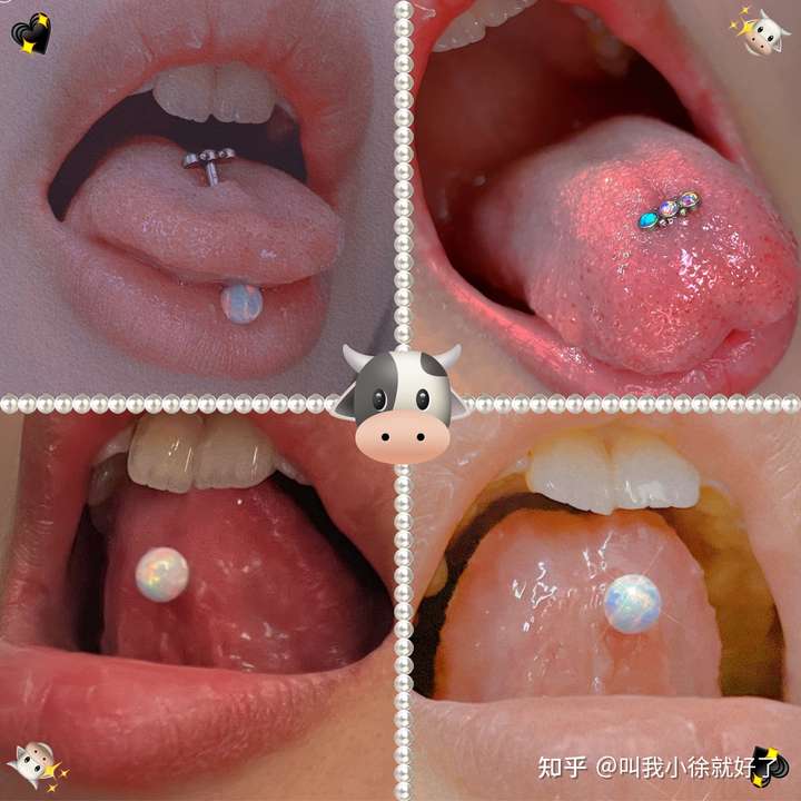 舌系带短可以打舌钉吗?