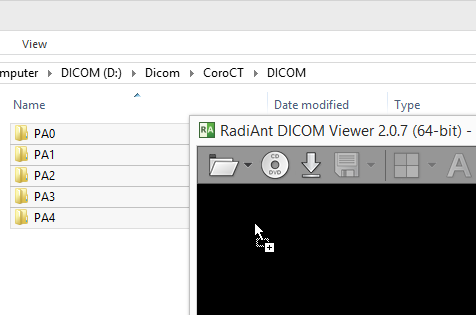 radiant专栏二如何从文件夹打开dicom