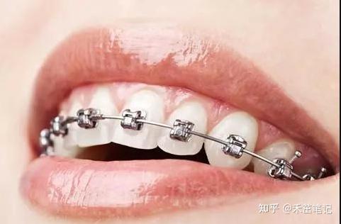 重庆牙齿矫正一般多少钱?