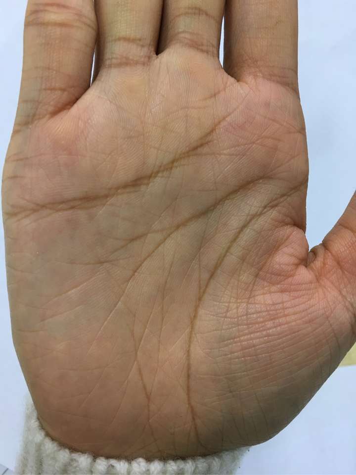 手相 #算命 婚姻线两个,第二个还分叉了……是不是我