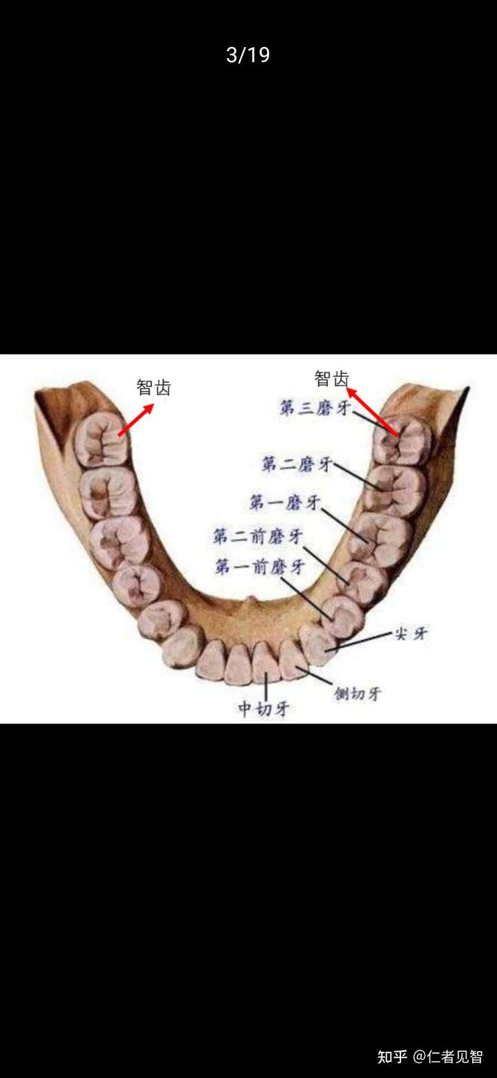 智齿的解剖学正规名称为"第三磨牙",因在人的智力发育旺盛时期(平均为