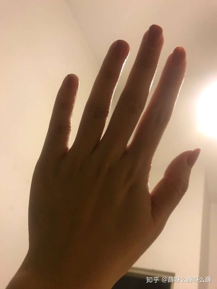 小孩子的手和老人一样干枯,多皱纹是怎么回事?