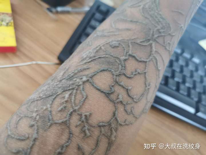 纹身已经激光洗三次了,昨天刚刚洗完第三次,两个月的时间可以洗干净吗