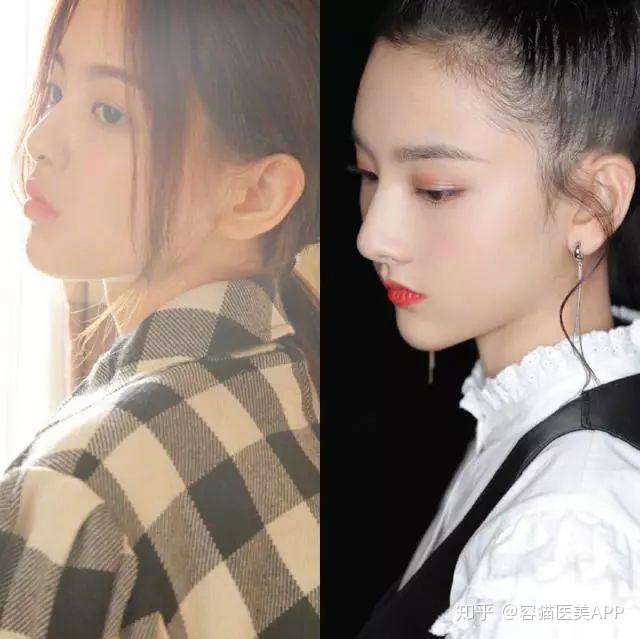 神仙侧颜和普通好看之间的鸿沟究竟是什么?