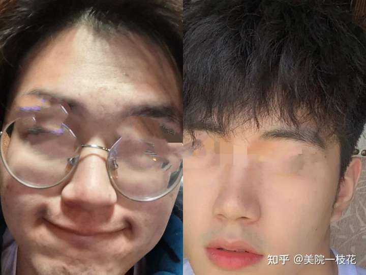 男朋友长得丑是种怎样的体验?