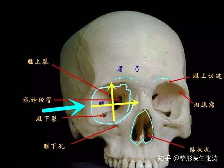 眼睛周围的轮廓是什么?