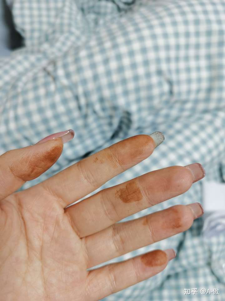 偶尔早上睡醒,几个手指尖有类似于血迹或者说铁锈之类