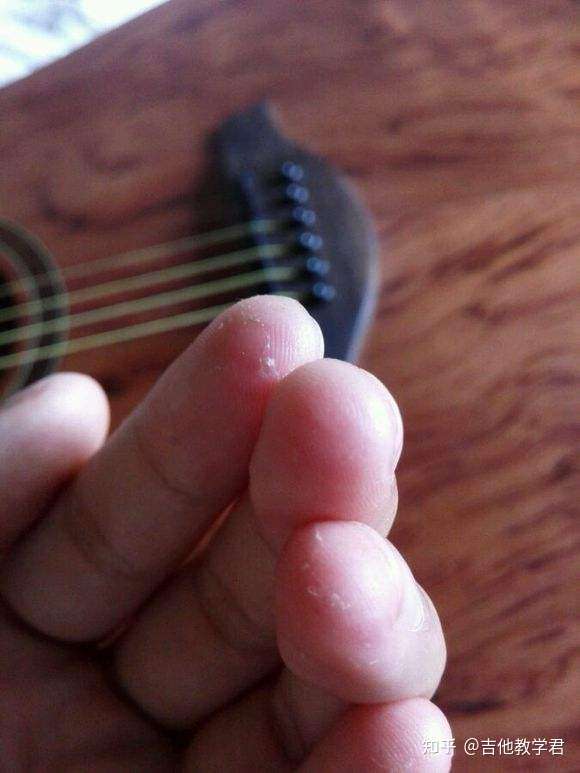有一点吉他基础,买了个不到一千的吉他,练习的时候手指疼咋办?