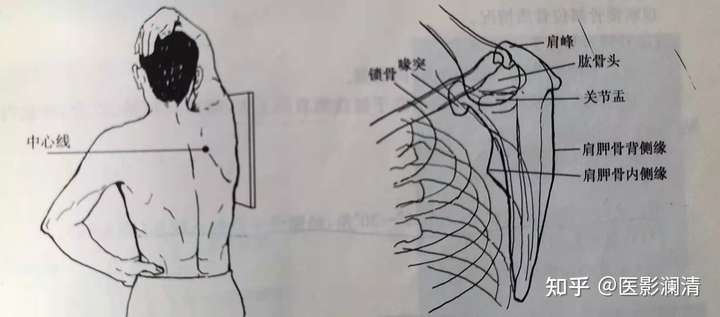 请问一下肩胛骨正侧位怎么摆位和影像显示谢谢