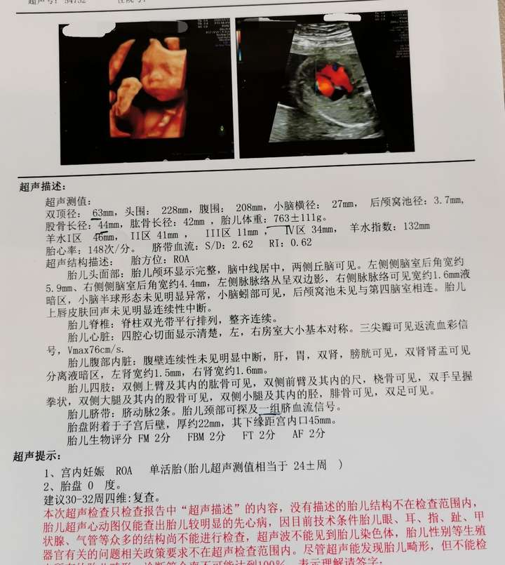 你第一次看到宝宝的四维彩超照片,是什么感觉?